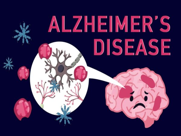 آلزایمر چیست